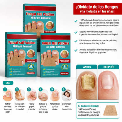 PARCHES ANTIHONGOS PARA UÑAS – PACK 3 CAJAS (48 PARCHES