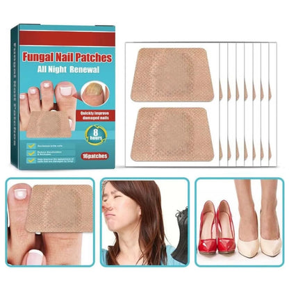PARCHES ANTIHONGOS PARA UÑAS – PACK 3 CAJAS (48 PARCHES